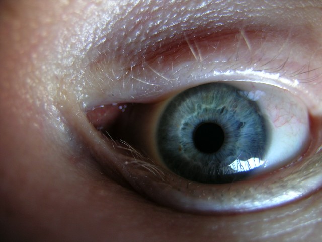 my right eye